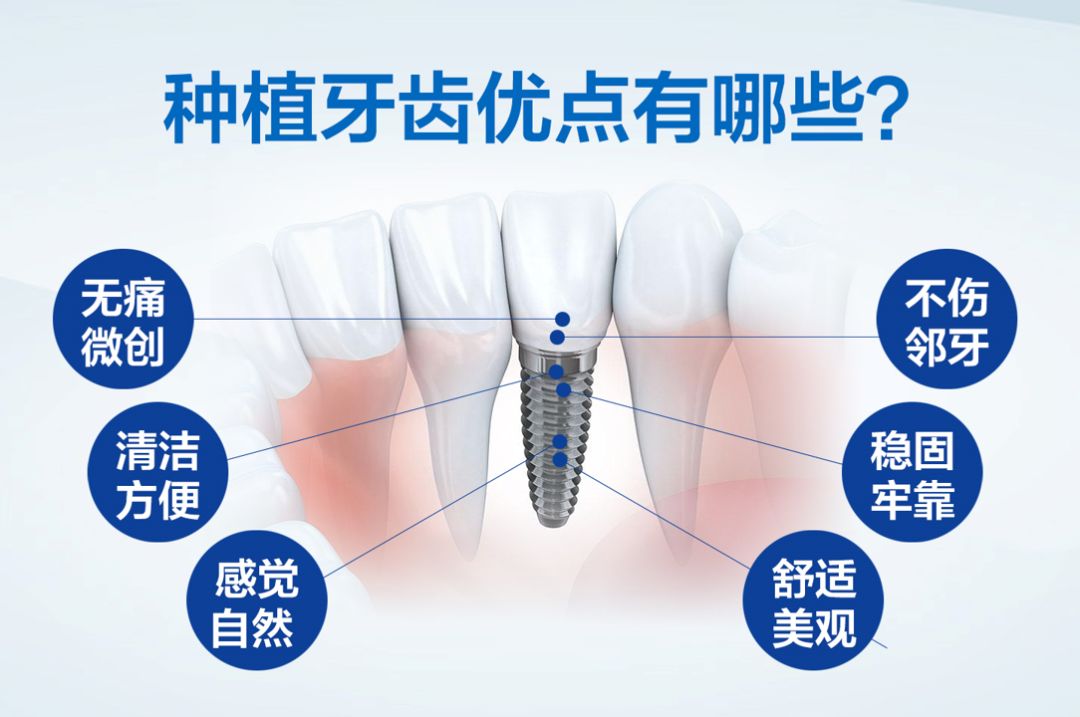 种植牙技术进展、材料革新与应用前景的最新消息